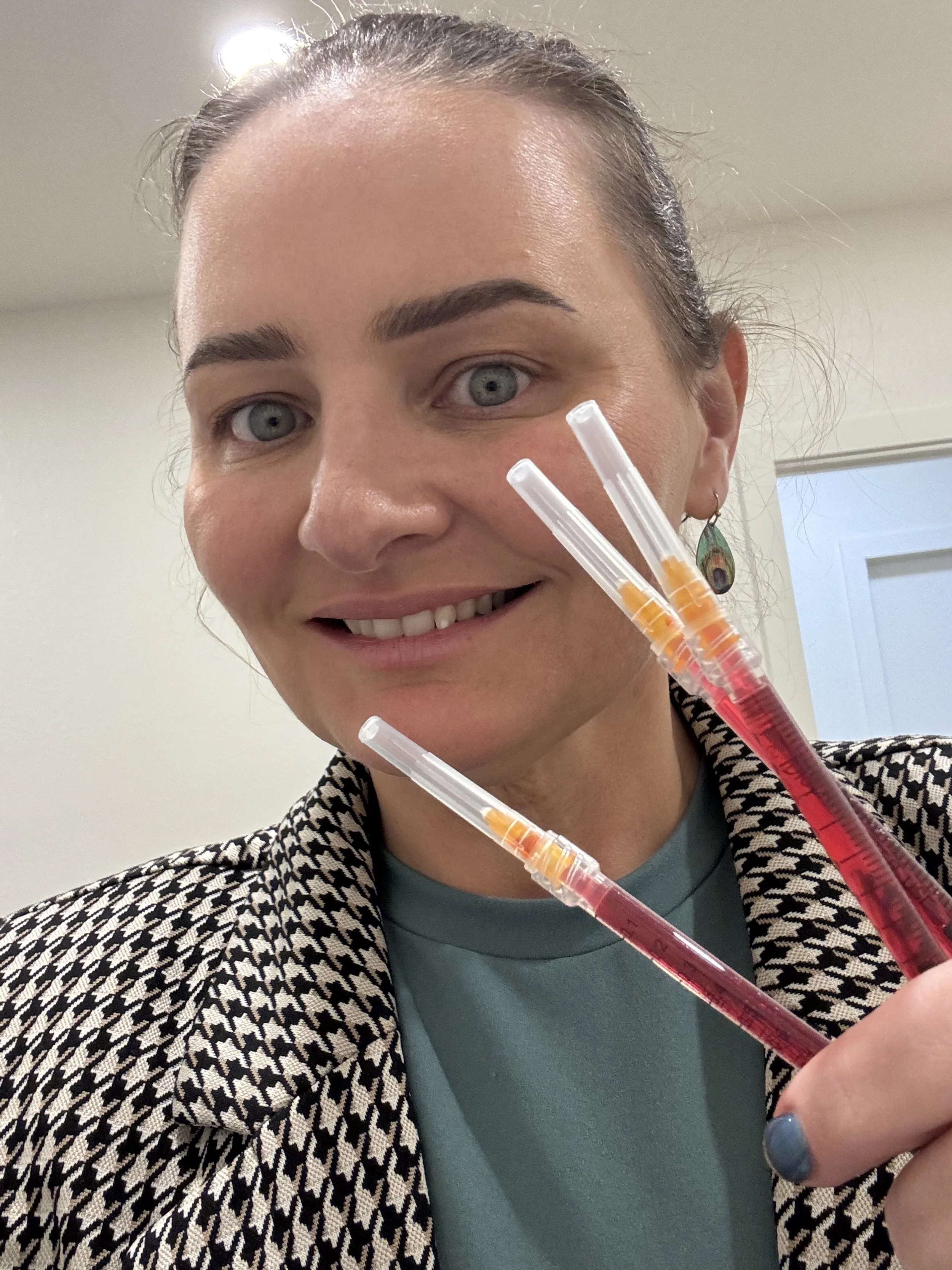 Refreshed Eye Area - After